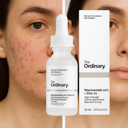 Niacinamida the ordinary